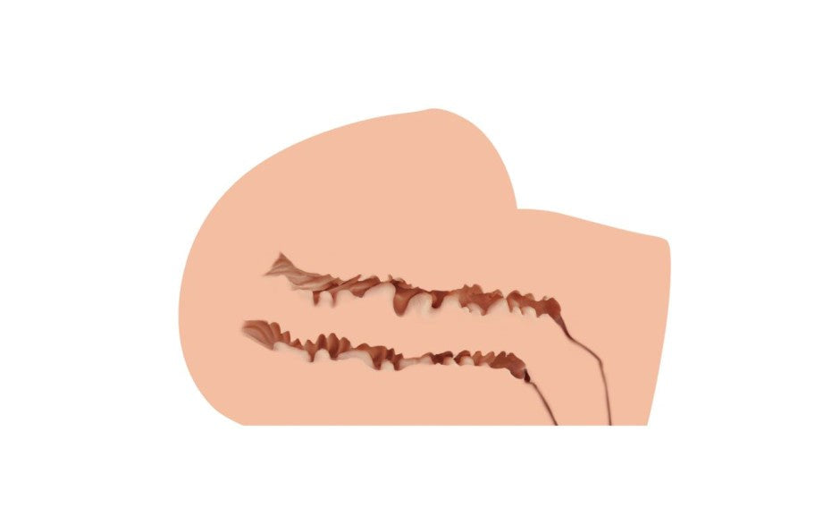 Naked Factory Scarlet Real Hip Anal and Vaginal Penetration Masturbator Premium TPE - - Masturbators and Strokers