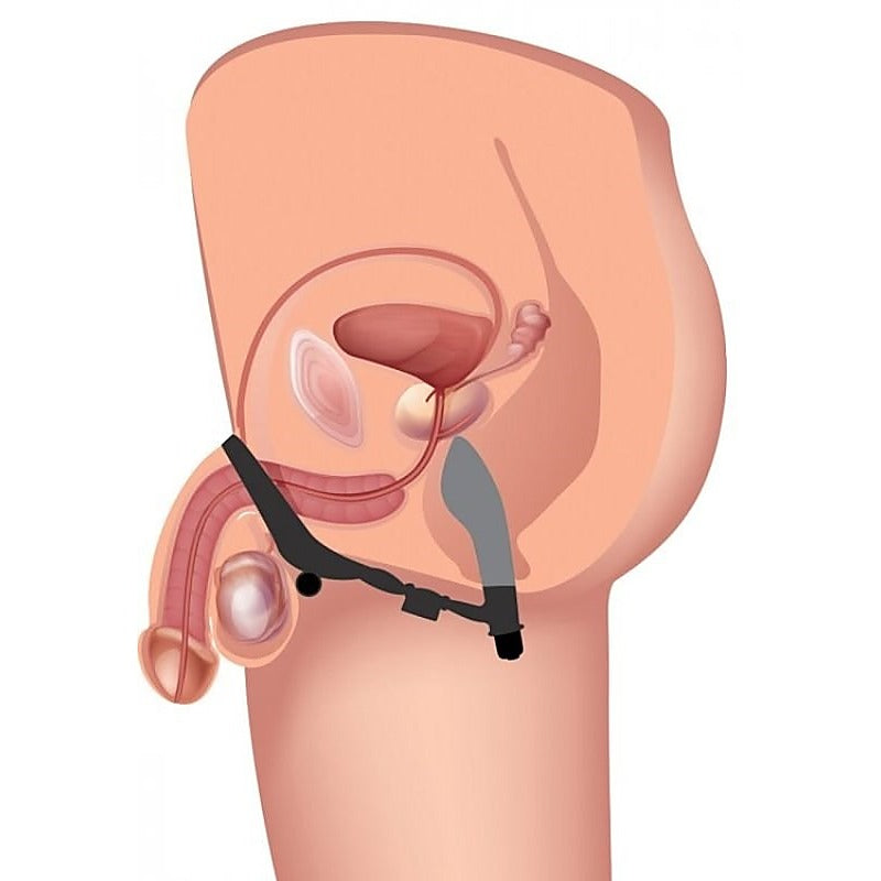 Epic Triple Stim Anal Plug Cock Ring by XR Brands - Cock Rings