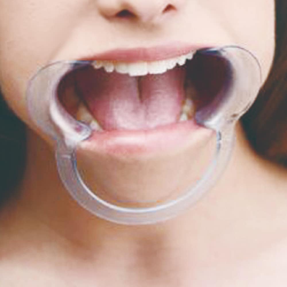 BDStyle Clear Cheek Retractor Dental Mouth Gag - Bondage Gags and Bits
